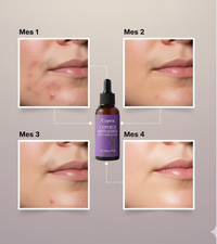 Aceite Natural Inhibidor de Vello™